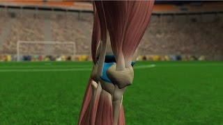 Lesiones de rodilla [upl. by Mafala]