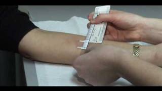 TB Skin Test  Mantoux Method [upl. by Margarita]