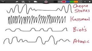 Irregular Breathing Patterns  EMTprepcom [upl. by Neeham]