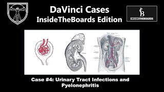 Urinary Tract Infections and Pyelonephritis DaVinci Cases  InsideTheBoards Edition Case 4 [upl. by Gerg660]