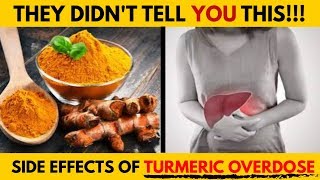 5 Terrible Side Effects of Too Much Turmeric [upl. by Howlond]