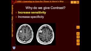 Introduction to Contrast Enhancement [upl. by Ingmar]