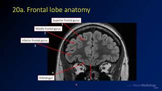 Neuroradiology review  brain gyral anatomy [upl. by Assena492]