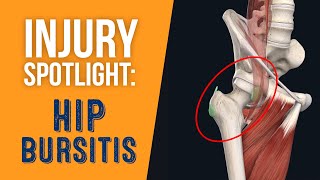 Top 3 Exercises For Trochanteric Hip Bursitis [upl. by Jo-Anne]