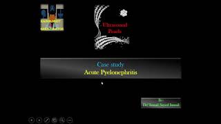 Ultrasound Pearls  Acute Pyelonephritis Dr Ismail Sayed Ismail [upl. by Yehudi]