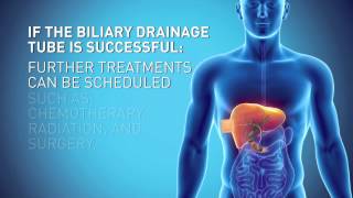 Biliary Drain [upl. by Nehr270]