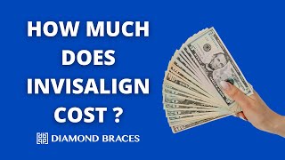 How Much Does Invisalign Cost [upl. by Auria]