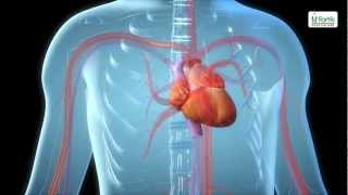 Angiogram  BRAIN angio procedure video [upl. by Annyl]