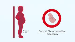 How Rh factor affects a pregnancy [upl. by Gula]