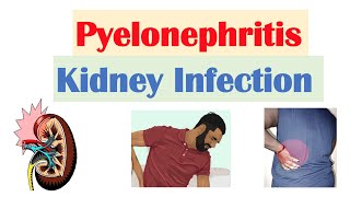 Pyelonephritis Kidney Infection  Causes Pathophysiology Signs amp Symptoms Diagnosis Treatment [upl. by Akcinahs]