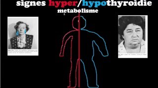 🔴 Dr Astuce  HYPERHYPOTHYROIDIES EXPLIQUÉES CLAIREMENT [upl. by Eibloc]