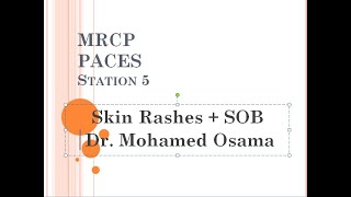 MRCP PACES  Station 5  Skin Rashes  SOB  Dr Mohamed Osama [upl. by Nalniuq]