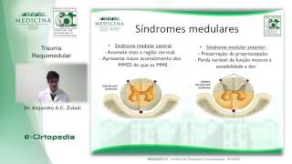 Trauma Raquimedular  Dr Alejandro A C Zoboli [upl. by Woods]