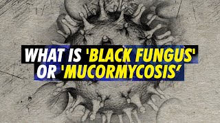 Black Fungus or Mucormycosis Deadly fungal infection making some COVID19 patients blind in India [upl. by Salhcin]