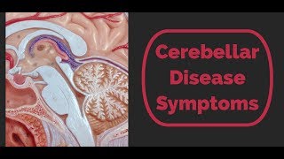 Cerebellar Disease Symptoms [upl. by Ginny]