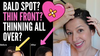 HIDING THINNING HAIR ON TOP FOR FEMALES HAIRSTYLE Tips For BALD Spots Thin Fronts And Parts [upl. by Marieann291]