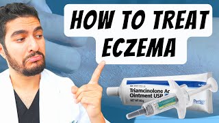 How To Treat Eczema Dermatologist Explains [upl. by Desdee]