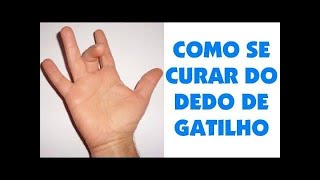 DEDO em GATILHO TENOSSINOVITE ESTENOSANTE CAUSAS amp TRATAMENTO Clínica Fisioterapia Dr Robson Sitta [upl. by Areval]