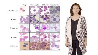 Maria Mota IMM 3 Nutrient sensing modulates malaria parasite virulence [upl. by Eemak]