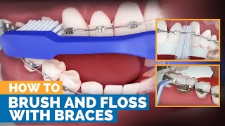 How to Brush amp Floss with Braces [upl. by Lienahs944]