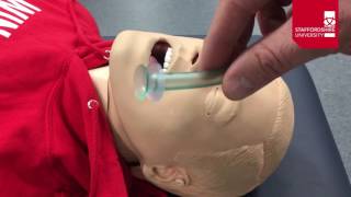 Nasopharyngeal Airway Insertion [upl. by Quin773]