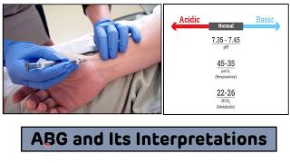 Arterial Blood Gas ABG Analysis  Arterial Blood Gas ABG Interpretations In 3 Easy Steps [upl. by Laeria868]