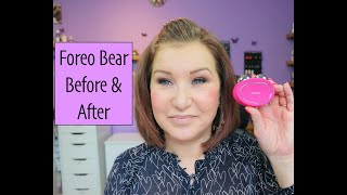 Foreo Bear Microcurrent for Hooded Eyelids  2 Week Review [upl. by Ardene]