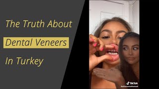 The Truth about Dental Veneers in Turkey [upl. by Kailey]