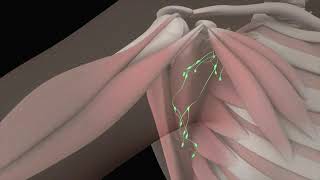 Axillary Anatomy 3D Animation of Axillary Lymph Node Dissection Procedure Part  1 [upl. by Merdith309]