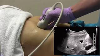 How I do it Ultrasound of the Abdomen [upl. by Lancaster321]