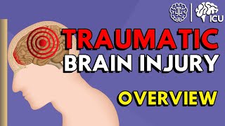 Overview of Traumatic Brain Injury TBI [upl. by Apollus468]