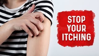 What Causes Hives and Itchiness  Urticaria Hives Treatment  Dr Berg [upl. by Lundell]