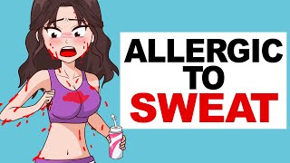 Allergic To Sweat [upl. by Mercedes740]