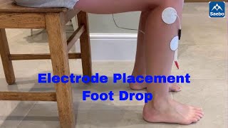 Electrode Placement for foot drop [upl. by Jemena]