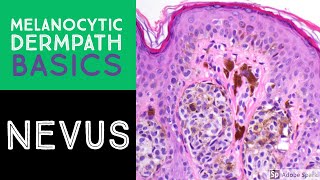 Melanocytic Dermpath Basics Benign Nevus [upl. by Eirehs]