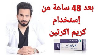 طريقة استخدام اكرتين لعلاج حب الشباب Acretin cream دكتور طلال المحيسن [upl. by Lehet]