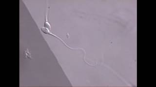 Sperm swimming in microscope field [upl. by Kynthia]