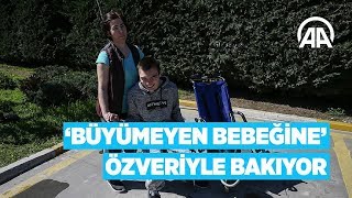 Büyümeyen bebeğine özveriyle bakıyor [upl. by Liebowitz]