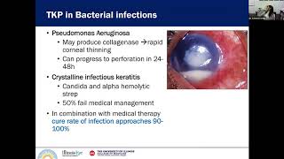 Penetrating Keratoplasty in Infectious Keratitis [upl. by Wailoo690]