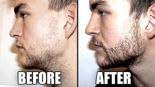 Trying a Beard Growth Kit for 2 Months  My RESULTS  CPH Grooming Review [upl. by Abrahamsen]