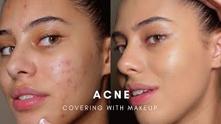 HOW TO COVER ACNE WITH MAKEUP BASE ROUTINE [upl. by Buehrer]