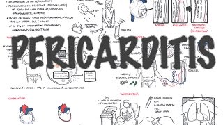 Septal Bounce  Constrictive Pericarditis  Thuan Nguyen [upl. by Eimerej]