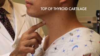 Thyroplasty Surgery by Dr Sunil Verma  UCI Health Voice amp Swallowing Center [upl. by Ahsir475]