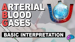 Basic ABG Interpretation  Arterial Blood Gases Part 3 [upl. by Auhsaj]