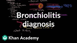 Bronchiolitis In Babies  What Should You Do  Channel Mum [upl. by Stephania]