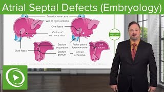 Atrial Septal Defects – Embryology  Lecturio [upl. by Verina]