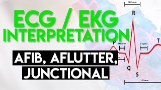 Atrial Rhythms  EKG Interpretation  LevelUpRN [upl. by Neitsabes]