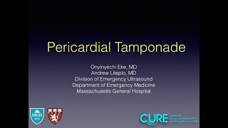 Pericardial Tamponade [upl. by Oman769]