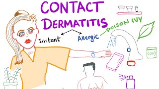 Contact Dermatitis [upl. by Ikeda58]