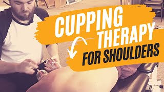 Cupping Therapy Techniques for the Shoulder [upl. by Ennaharas]